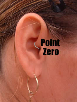 What Everyone Should Know About Using Ear Stapling To Lose Weight.