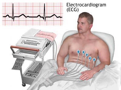 Do You Know What Myocarditis Is