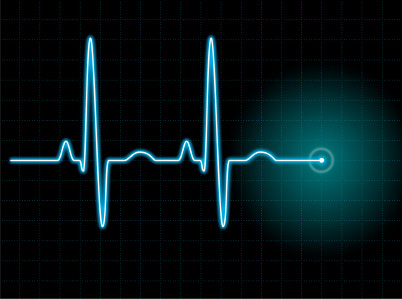 What Is An EKG